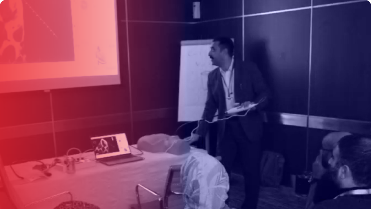 Trans Oesophageal Echocardiography for Anaesthesia and ICU